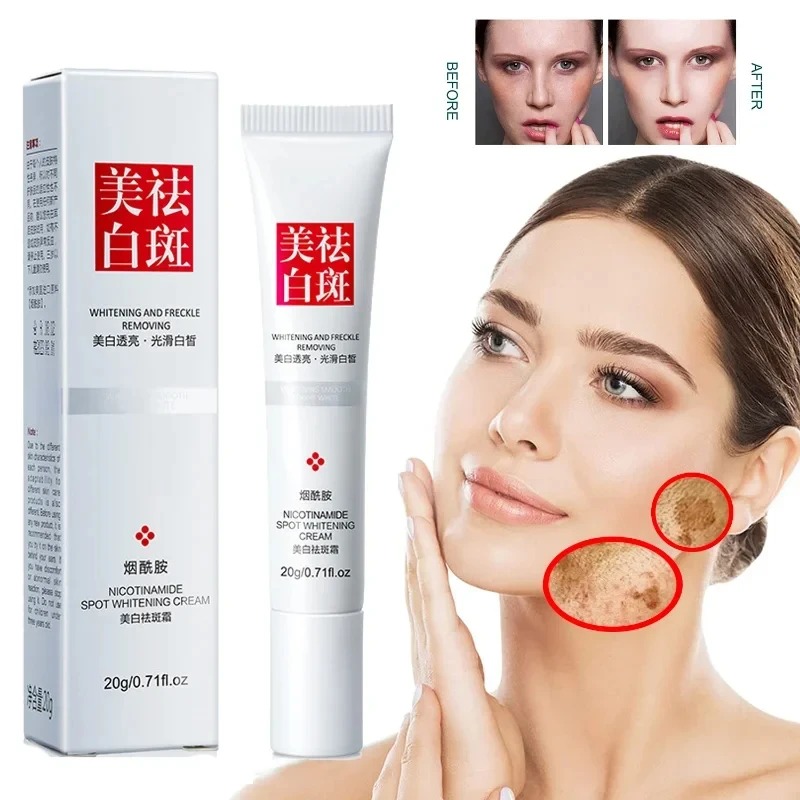 Verblasst und verbessert Somme – Skincare Glow Bewertung und Preis