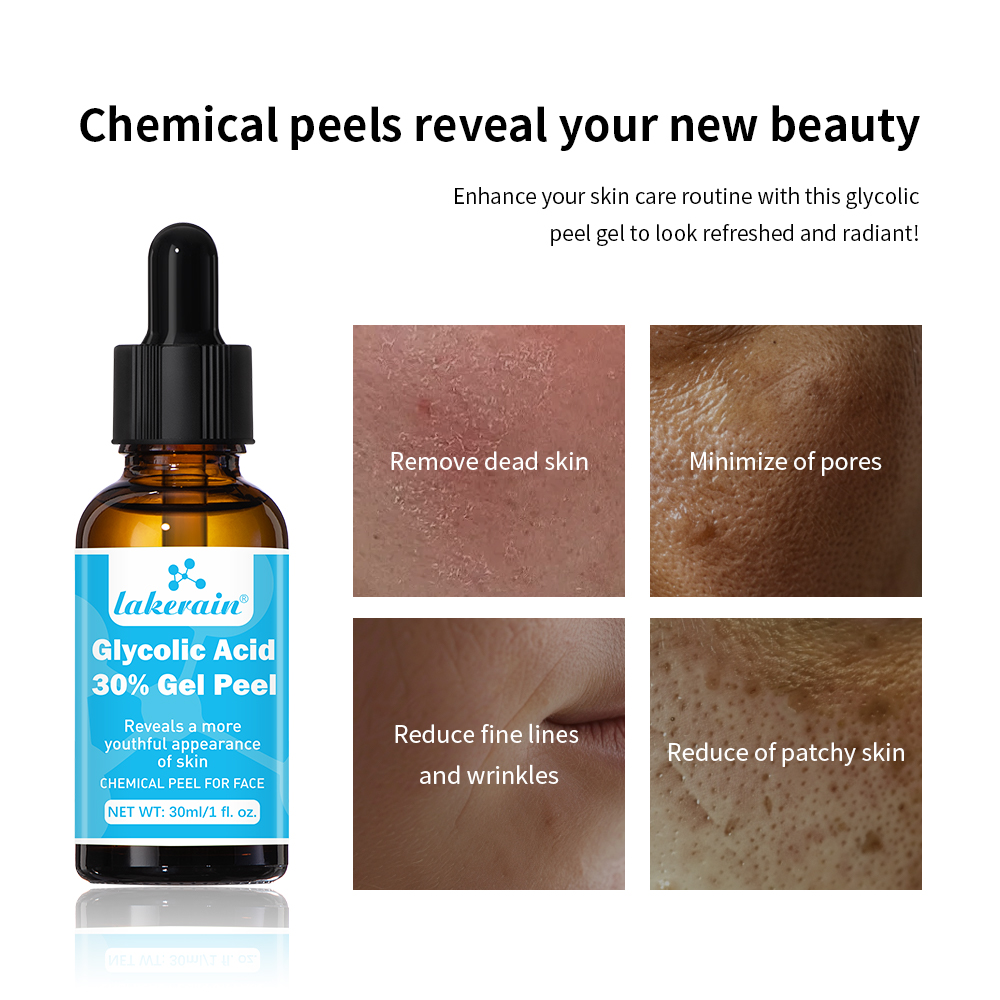 30 % Glykolsäure-Peeling-Gel,  – Lactic Acid Toner Bewertung und Preis